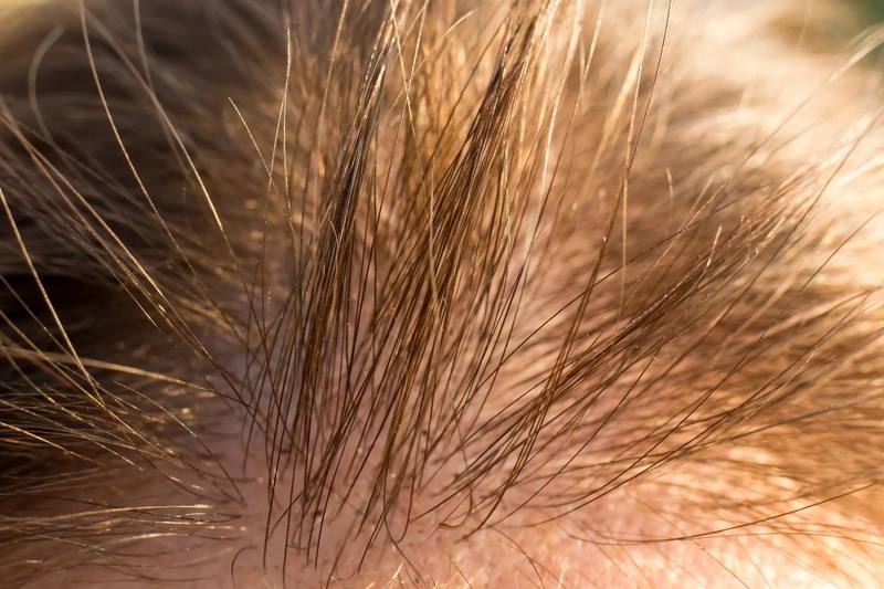 hair