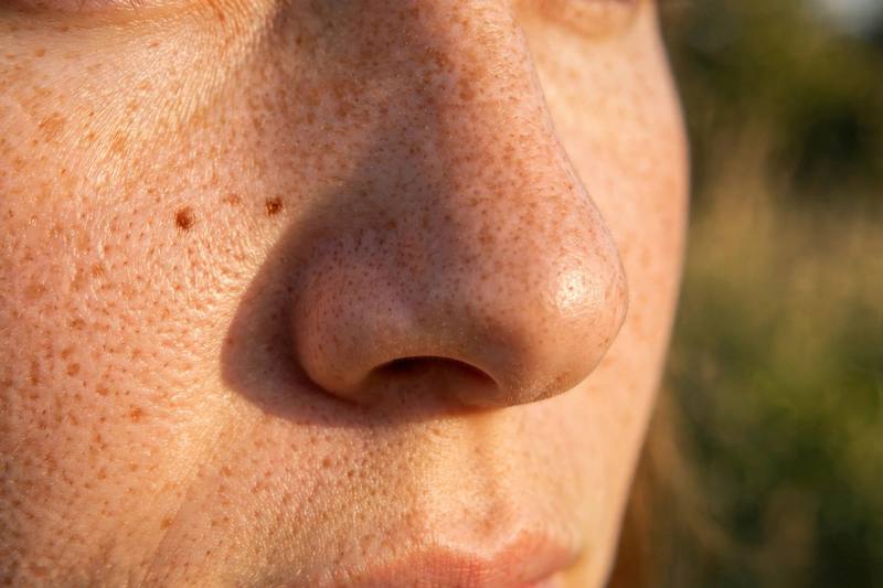nose